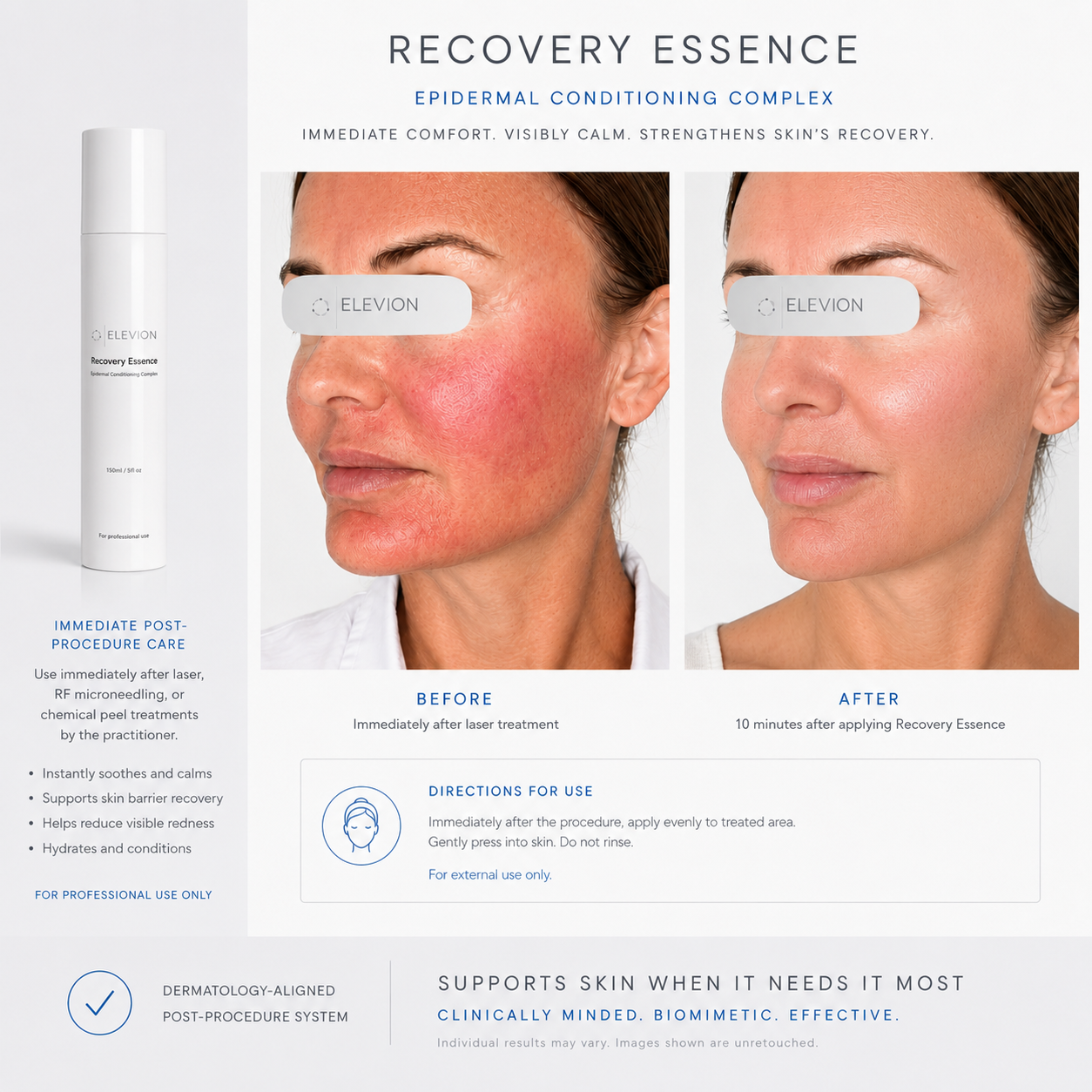 Elevion Recovery Essence - Clinical Size