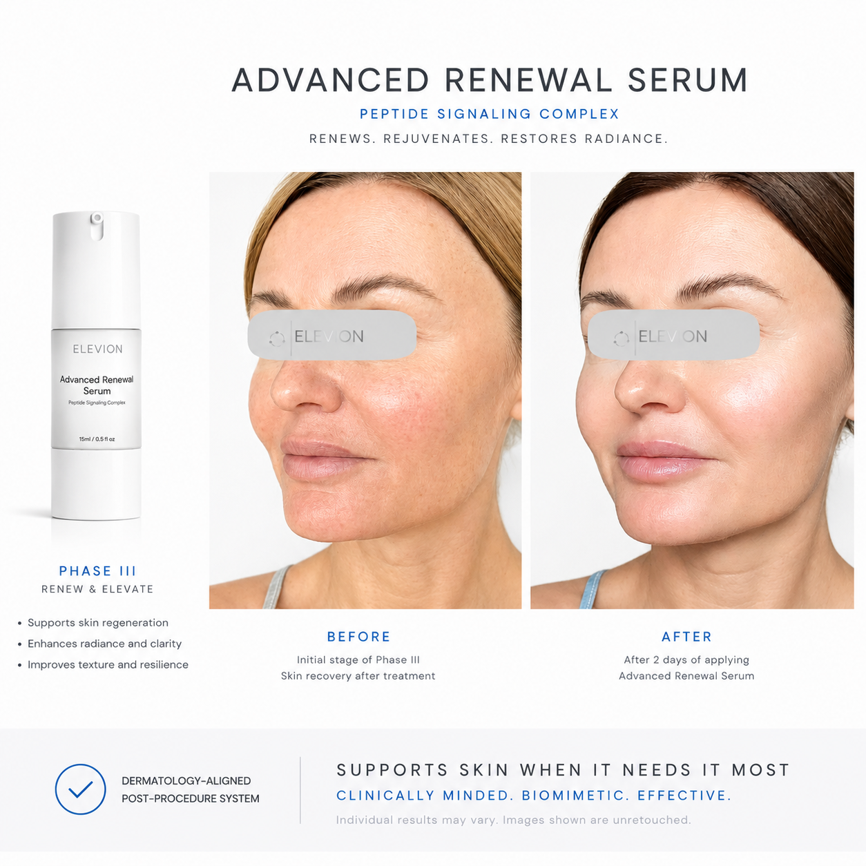 Elevion Clinical Recovery System